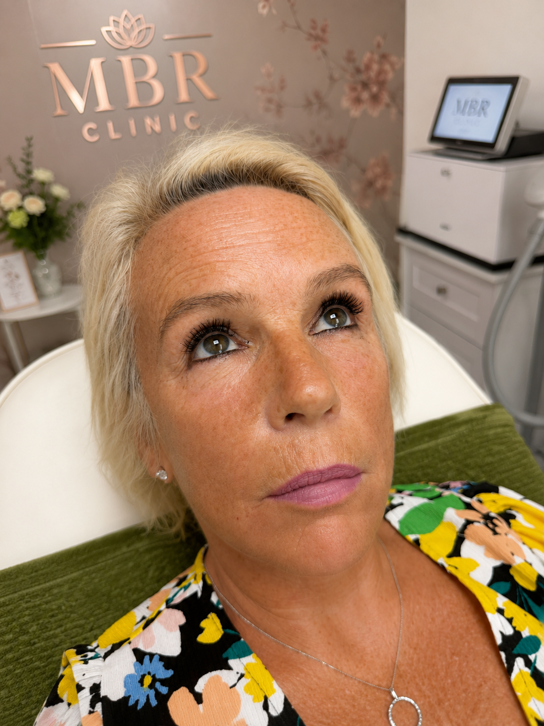 After treatment result